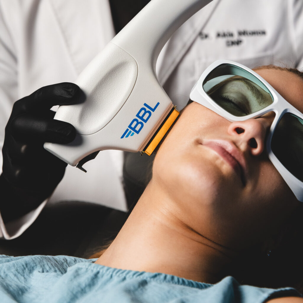 A patient shuts her eyes as an expert provider performs a BBL treatment, which serves as an excellent complement for laser resurfacing in New York City.
