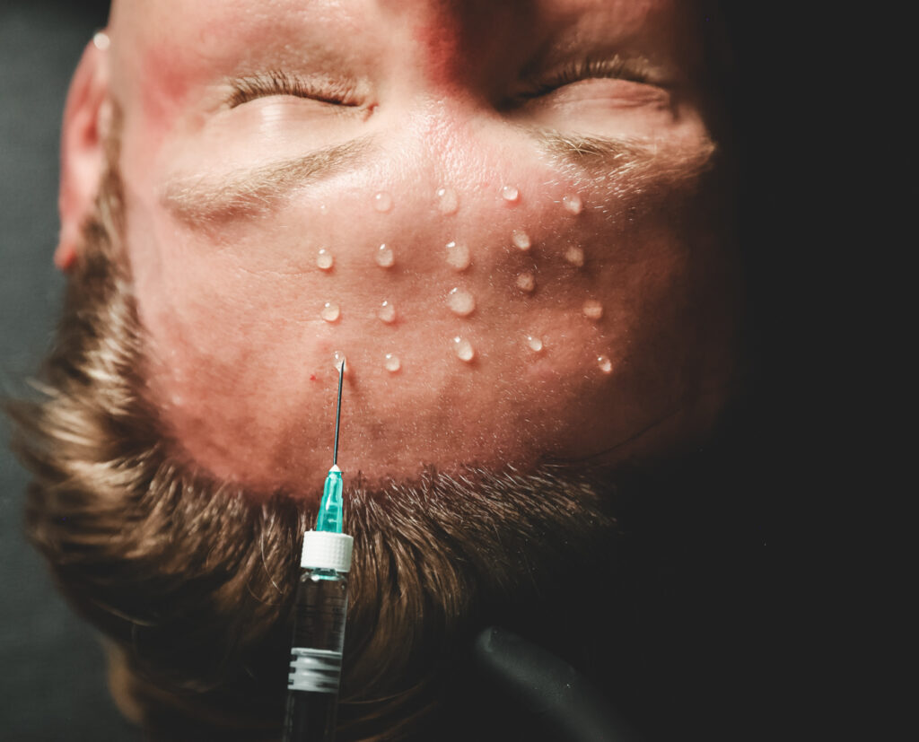 A man receives injection for a salmon DNA facial in New York City