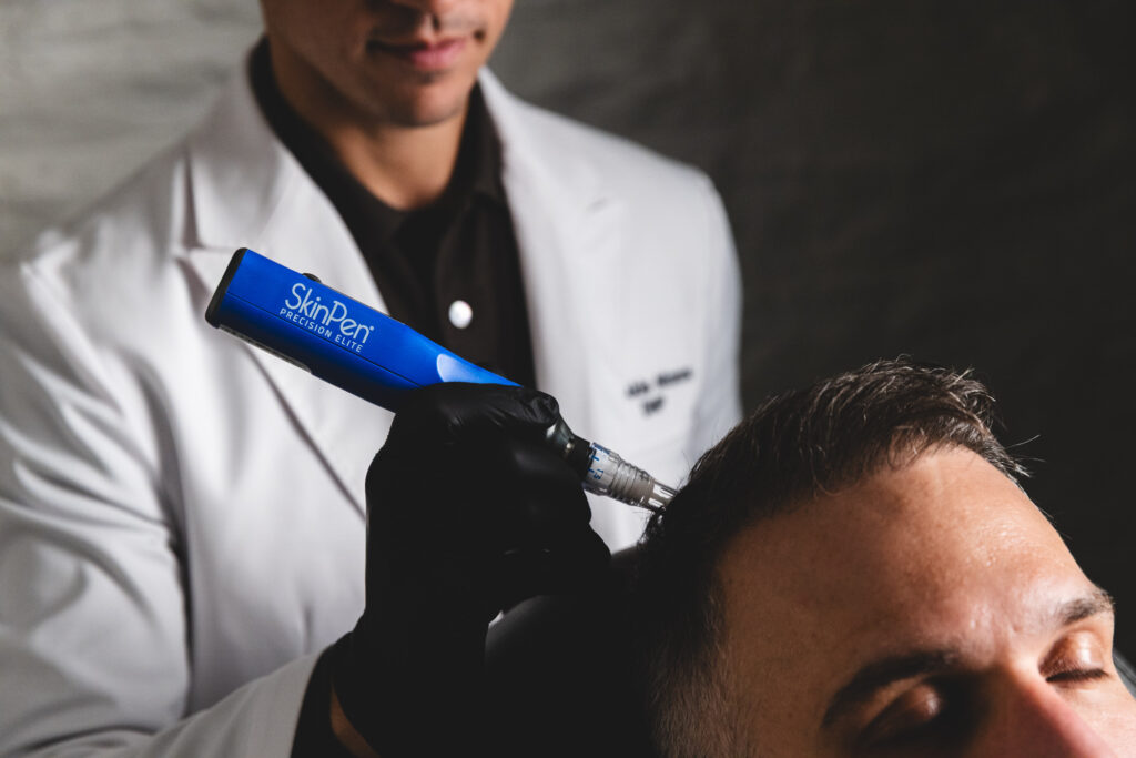 Dr. Akis performs a balding treatment in New York City.