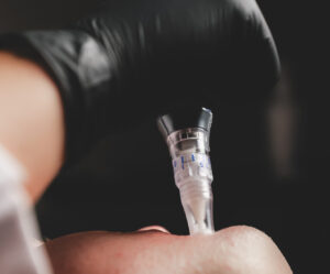 A member of our team prepares a salmon DNA facial in New York City