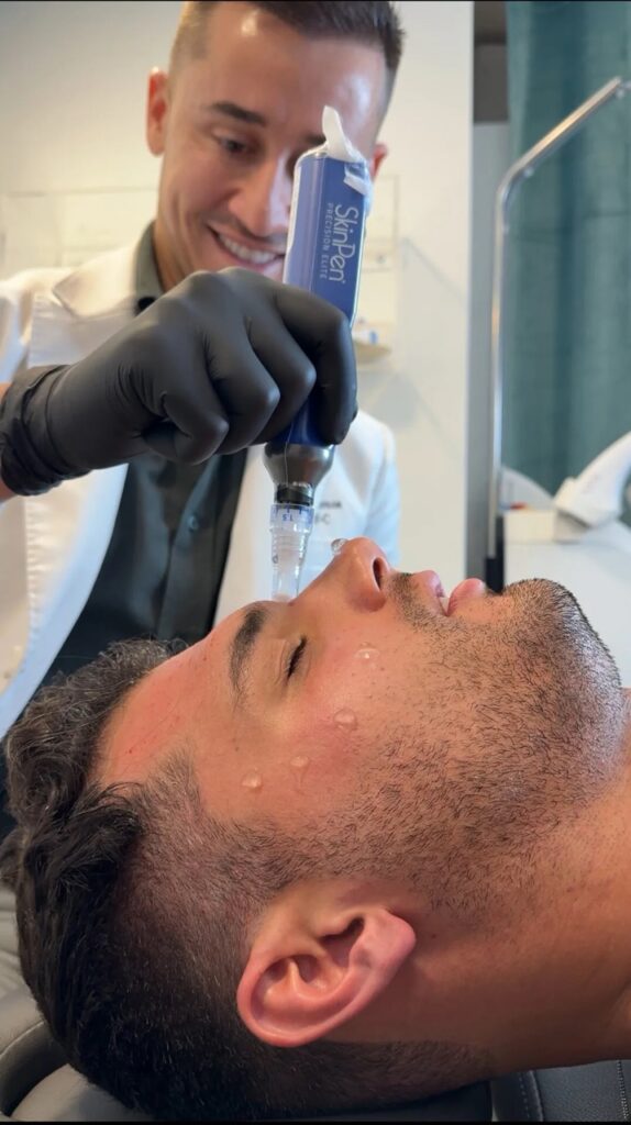 Dr. Akis performs a SkinPen non-invasive skin tightening treatments in New York City
