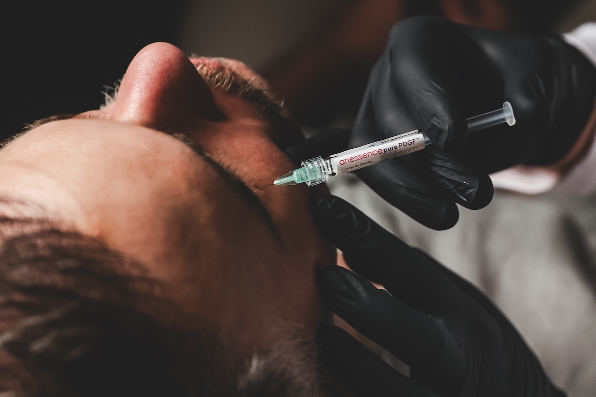 Close-up of a patient at Aion Aesthetics receiving under-eye bags treatment in New York City.